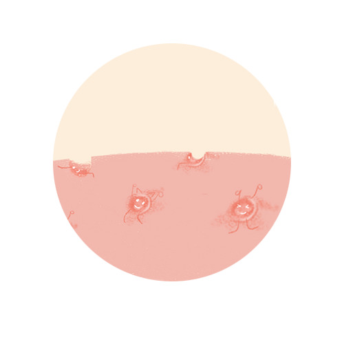 皮肤痘印痘坑高清PNG透明免扣设计素材免费下载