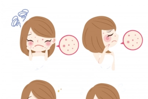 矢量痘痘肌肤问题