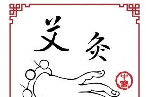 艾灸图